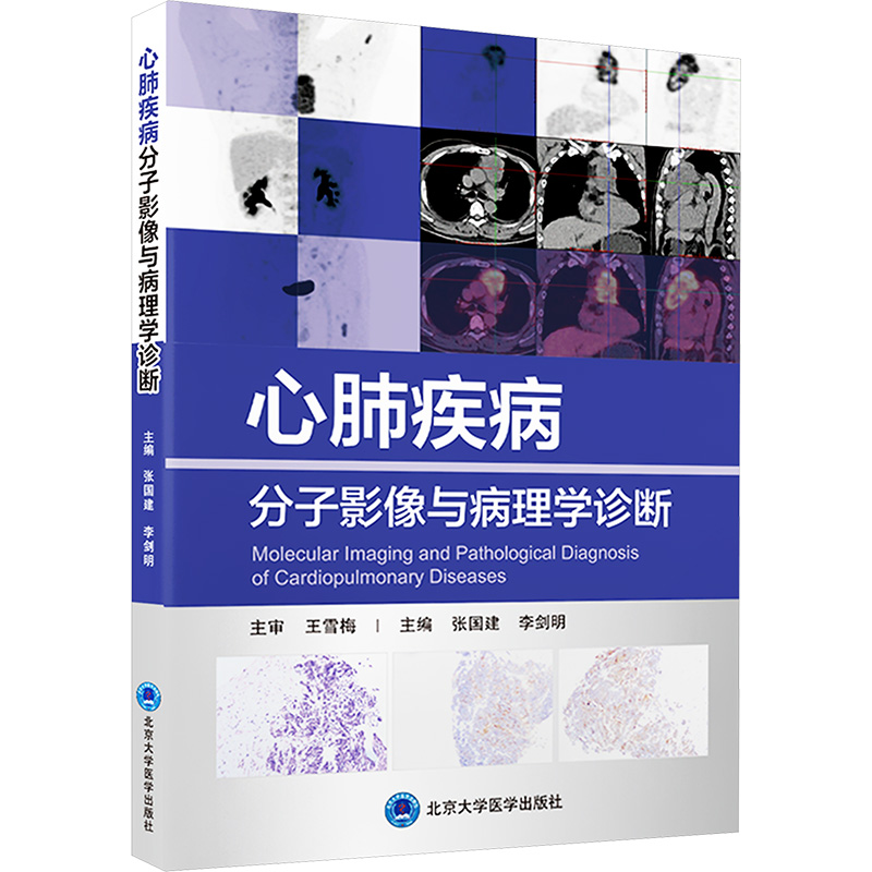 《心肺疾病分子影像与病理学诊断 》